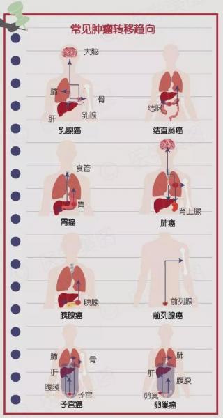 乳腺癌转移肝挂什么科