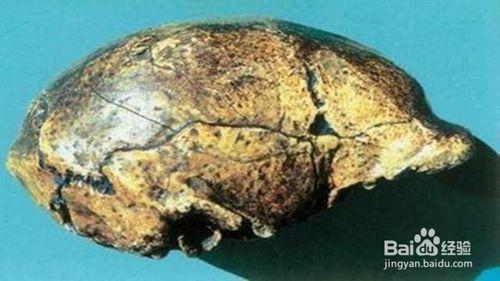 什么是人体最坚硬的器官