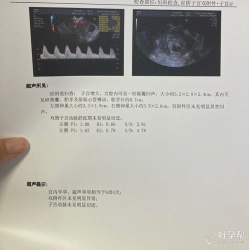 胎芽6mm实际受孕多少天