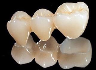 刚装烤瓷牙有什么反应